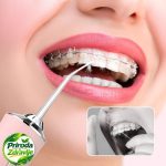 Aparat za ispiranje zuba i desni Oralni Irigator - Slika 3