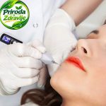 Plazma olovka za uklanjanje pega mrlja i bradavica - Slika 2
