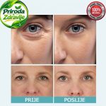Instant serum protiv podočnjaka bora oko očiju i tamnih krugova - Slika 5