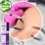 Botox bez igle za instat rezultate oko očiju - Slika 2