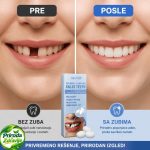 Privremeni zub – brzo rešenje za polomljen ili oštećen zub - Slika 5
